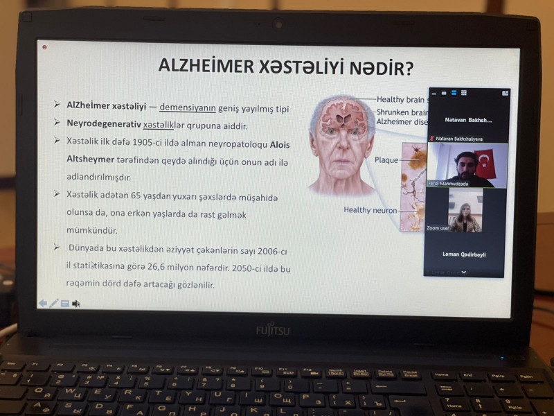 BDU-da Alzheimer xəstəliyinin kök hüceyrə ilə müalicəsinə dair seminar