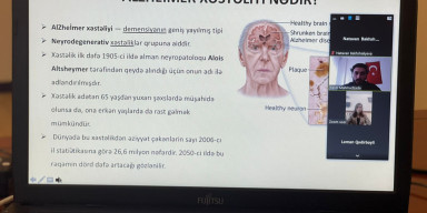 BDU-da Alzheimer xəstəliyinin kök hüceyrə ilə müalicəsinə dair seminar