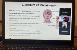 BDU-da Alzheimer xəstəliyinin kök hüceyrə ilə müalicəsinə dair seminar