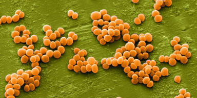 A scientific seminar on the topic "Staphylococcus aureus: A Serious Threat Facing Modern Medicine" was held