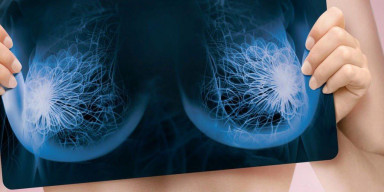 Süd vəzi xərçənginin diaqnostikasında yeni biomarkerlərin tədqiqi mövzusunda elmi seminar keçirilib