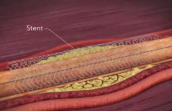 Ümumi və qeyri-üzvi kimya kafedrasının müəllimi Bağıyeva Məlahətin təqdimatında elmi seminar keçirildi.